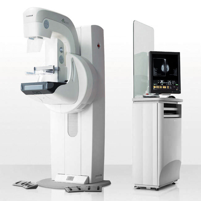 mammografo digitale