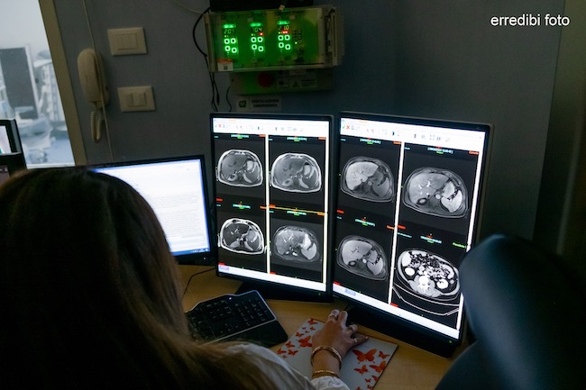 risonanza magnetica pescara